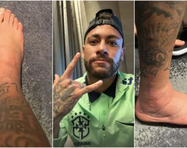 Neymar posta foto do tornozelo