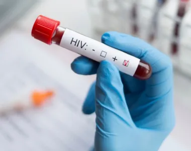 Incidência de HIV foi muito baixa entre os participantes do estudo