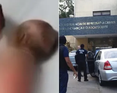 Após ser queimada durante uma confusão entre os pais, a bebê mudará de moradia