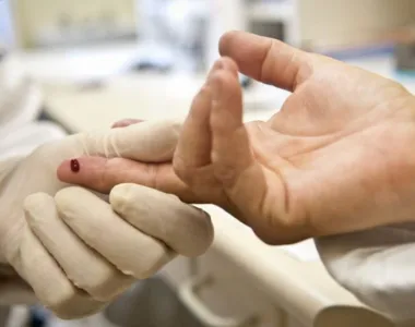 Unaids em colaboração com parceiros globais e nacionais para combater a doença