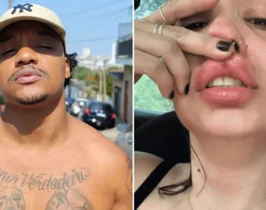 Laranjinha é acusado de agressões
