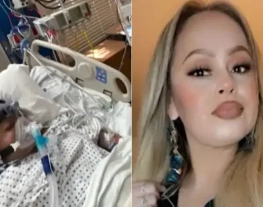 Amiga da mulher percebeu que braços e pernas dela estavam “pretos”