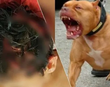 Pitbull  ataca criança  em Teixeira de Freitas