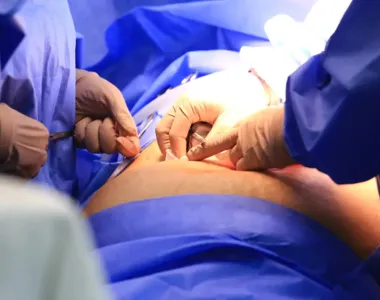 Texto retornará para análise dos senadores