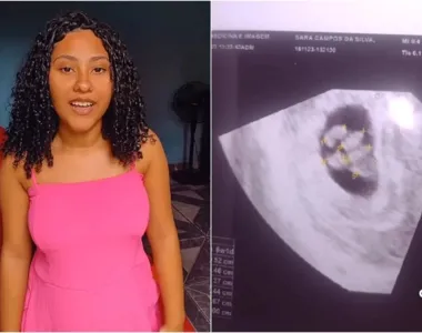 Sara viralizou nas redes mostrando o momento da ultrassonografia