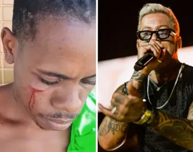 Igor kannário se desentendeu com um homem e deu um murro nele