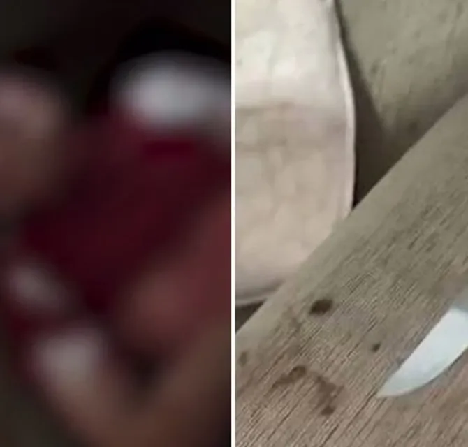 Imagem ilustrativa da imagem Vídeo: pai esfaqueia o filho autista e grava o garoto agonizando