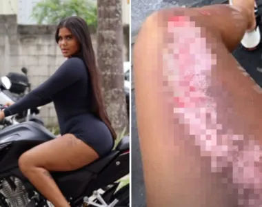 Suane Santos caiu de moto