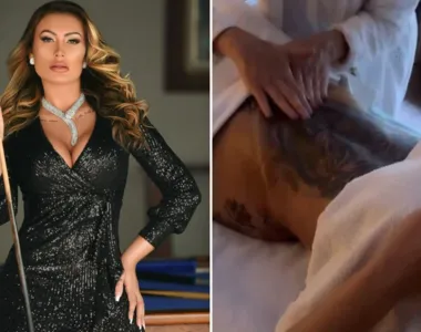 Andressa Urach  retirou costelas