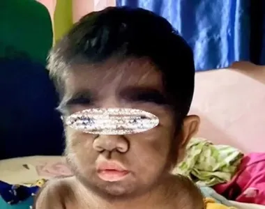Menino nasceu nas Filipinas