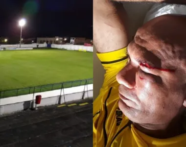 José Domingos Dias tomou um murro no rosto