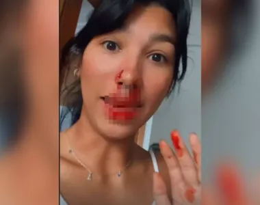 Jovem ficou com o nariz sangrando após agressão