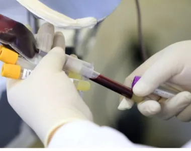 A hemodiálise é uma das modalidades da terapia renal substitutiva que possui a função de limpar o sangue de maneira mecânica
