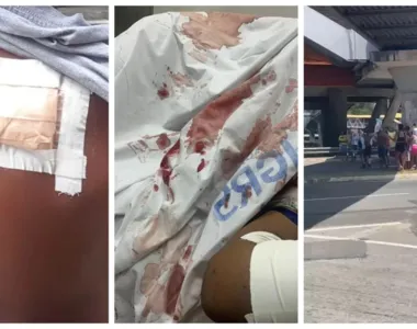 Criança de 5 anos foi um dos inocentes baleados no decorrer da operação policial