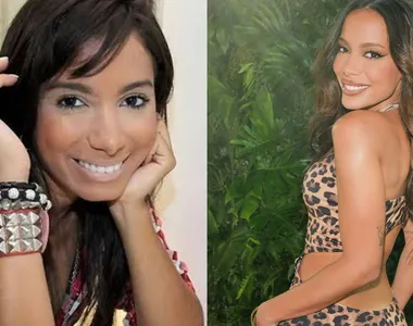 Antes e depois da cantora Anitta