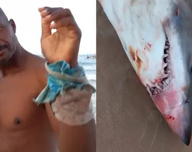 Pescador que supostamente teria sido atacado por um tubarão na realidade não sofreu um ataque, e sim um incidente