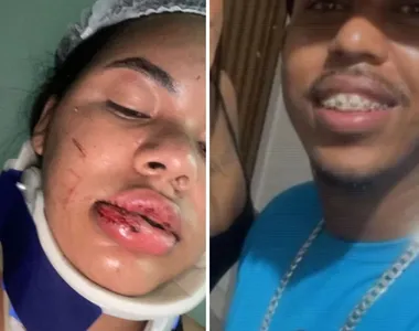 Mulher divulgou um vídeo exibindo os hematomas nas redes sociais