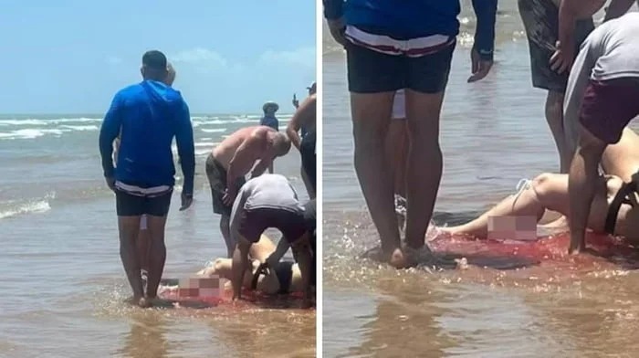 Mulher foi mordida enquanto nadava na parte rasa do mar