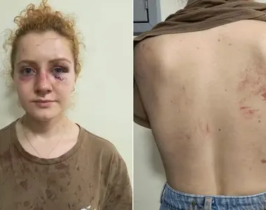 Vilena Teixeira, de 26 anos, denuncia ter sofrido uma série de agressões