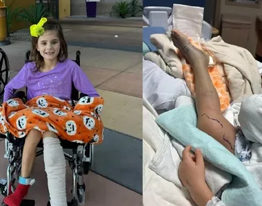 A criança de 7 anos foi picada por uma cobra