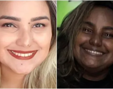 Sabrina Gomes tem tumor e síndrome que fazem mudar cor da pele