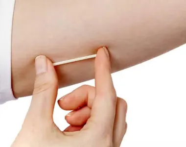 Anvisa não quer conta com o implante!