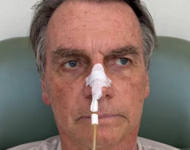 Bolsonaro já não está mais usando sondas