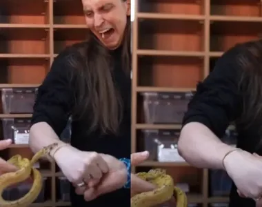 Momento que o influenciador é picado pela cobra