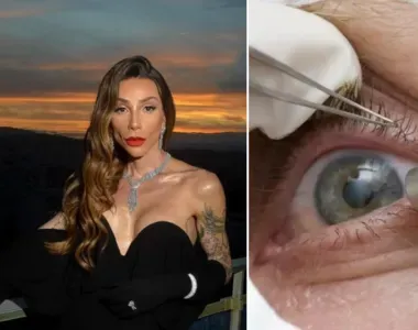 Maya deixou os olhos castanhos para trás após o procedimento
