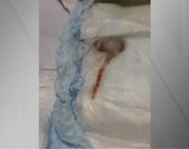 Rato morto foi encontrado dentro de fralda