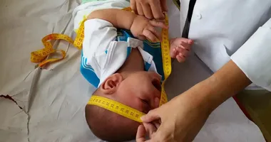 Imagem ilustrativa da imagem Ministro garante pagamento de grana para vítimas do Zika vírus