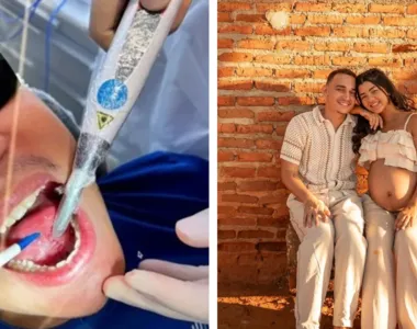 Cantor deu detalhes do procedimento, e comaprrtilhou resposta inusitada da comapanheira