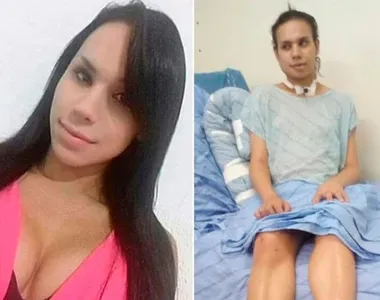 Mulher ficou com sequelas graves após agressão
