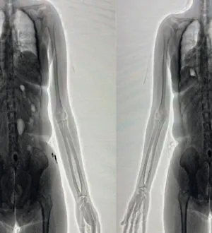 Imagem ilustrativa da imagem Mulher entoca maconha nas partes íntimas e é flagrada em presídio