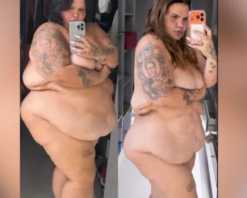 Imagem ilustrativa da imagem 