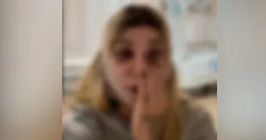 Imagem ilustrativa da imagem Maya Massafera deixa web apreensiva ao surgir com hematomas no rosto