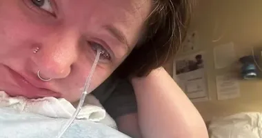 Imagem ilustrativa da imagem Mulher fica com um olho 'baqueado' após lavar roupa; entenda