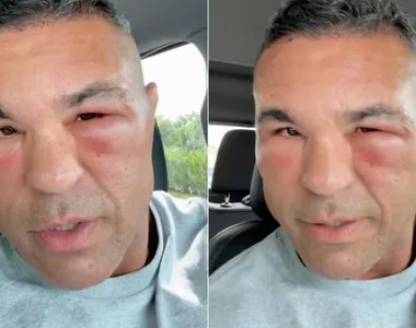 Ex-lutador Vitor Belfort