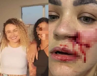 Blogueira conta que foi atacada pelo casal