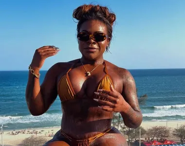 Jojo passou por cirurgia bariátrica