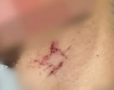 Vítima tinha várias marcas de agressões pelo corpo