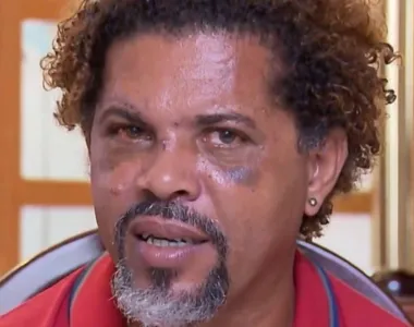 Givaldo ficou conhecido como 'mendigo do amor'