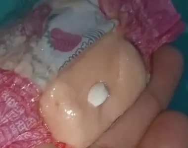 Mãe encontrou outros dois doces com um comprimido branco