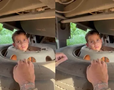 Brincadeira 'deu ruim' para o pequeno