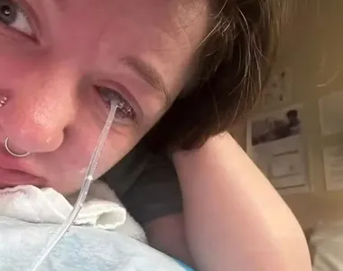 Desah teve uma lesão na córnea do olho direito