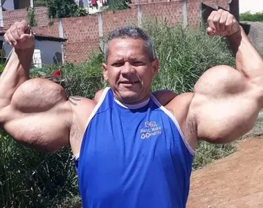 Arlindo de Souza ficou famoso pelo físico incomum