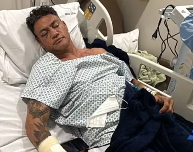Lutador recebeu alta após passar por cirurgia na mão direita
