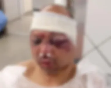 Rodoviário foi espancado por moradores dentro de casa