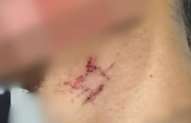 Imagem ilustrativa da imagem 