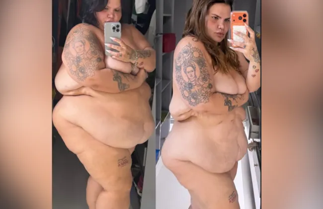 Imagem ilustrativa da imagem Nua, Thais Carla exibe transformação após perder 85 kg